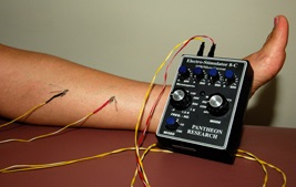 Electroacupuncture is being used on a patient's leg. The stimulation should not be painful.